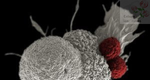 ¿Qué es el Cáncer y cómo podemos combatirlo desde la investigación?