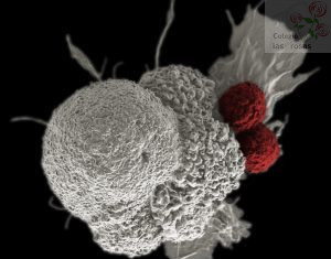 ¿Qué es el Cáncer y cómo podemos combatirlo desde la investigación?